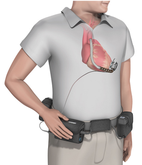 640 (100).png