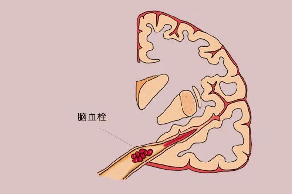 91C8E9803CD8A5CB3E02C1709912C6BA5FF28201_size22_w600_h400.jpeg